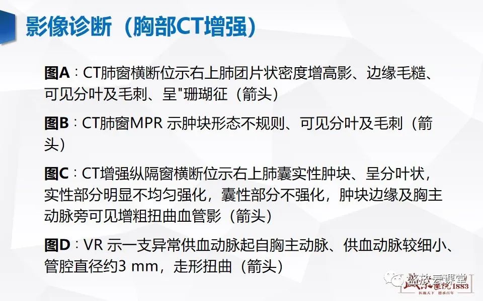 影像PPT - 【PPT】肺隔离症的影像分析-24