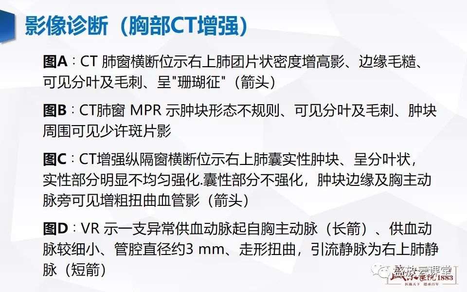 影像PPT - 【PPT】肺隔离症的影像分析-26