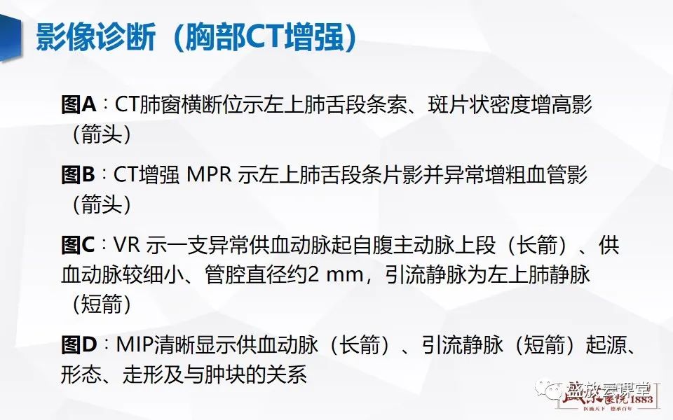 影像PPT - 【PPT】肺隔离症的影像分析-28