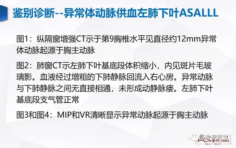 影像PPT - 【PPT】肺隔离症的影像分析-46