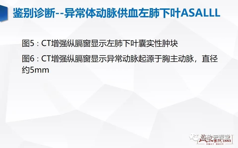 影像PPT - 【PPT】肺隔离症的影像分析-48