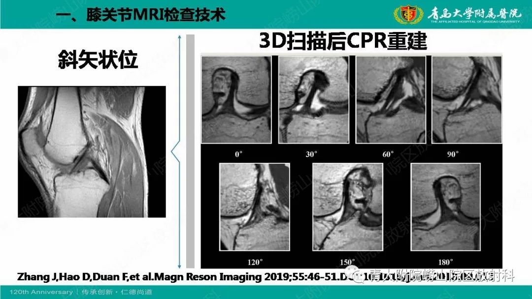 影像PPT - 【PPT】膝关节半月板及常见韧带损伤的磁共振诊断-4