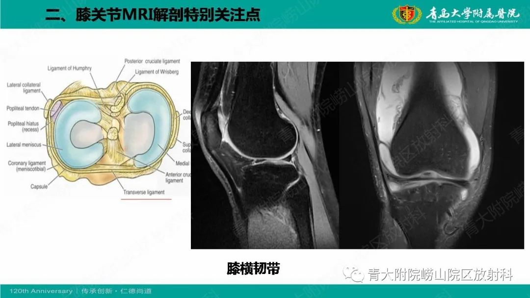 影像PPT - 【PPT】膝关节半月板及常见韧带损伤的磁共振诊断-7