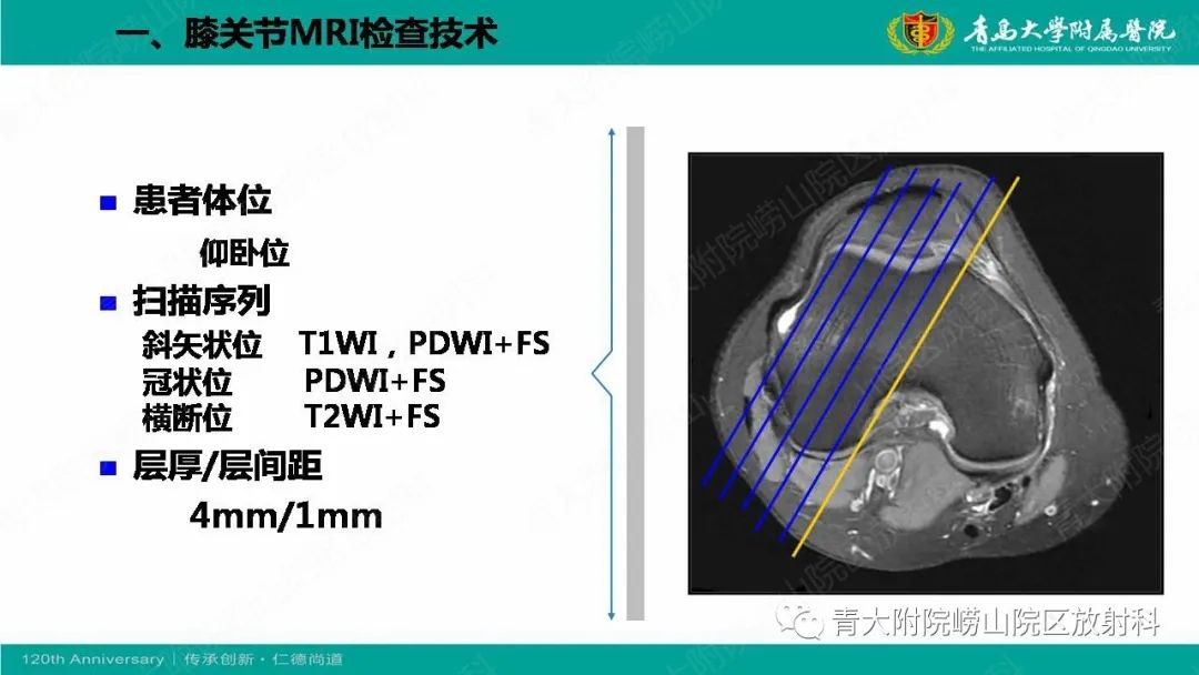 影像PPT - 【PPT】膝关节半月板及常见韧带损伤的磁共振诊断-3