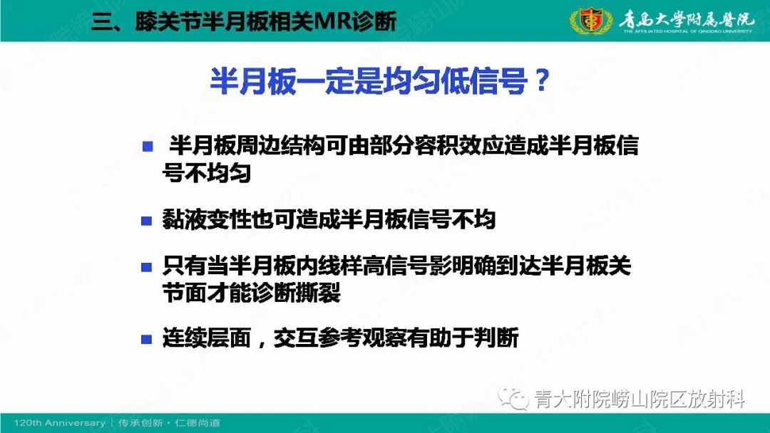 影像PPT - 【PPT】膝关节半月板及常见韧带损伤的磁共振诊断-25