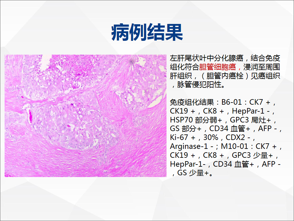 影像PPT - 【病例】肝脏胆管细胞癌1例CT及MR影像-18