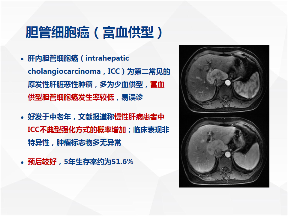 影像PPT - 【病例】肝脏胆管细胞癌1例CT及MR影像-28