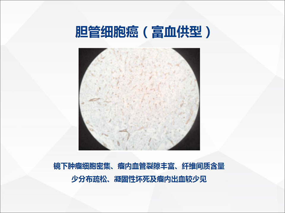 影像PPT - 【病例】肝脏胆管细胞癌1例CT及MR影像-29