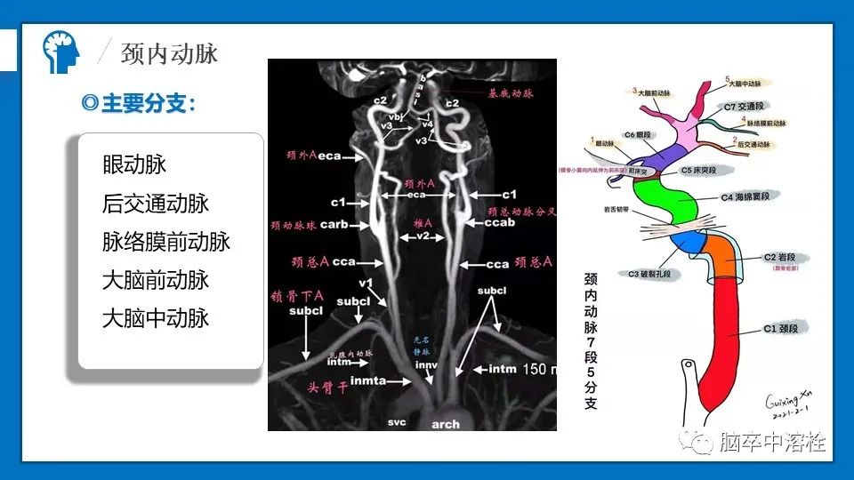 影像PPT - 【PPT】脑血管经典解剖-8