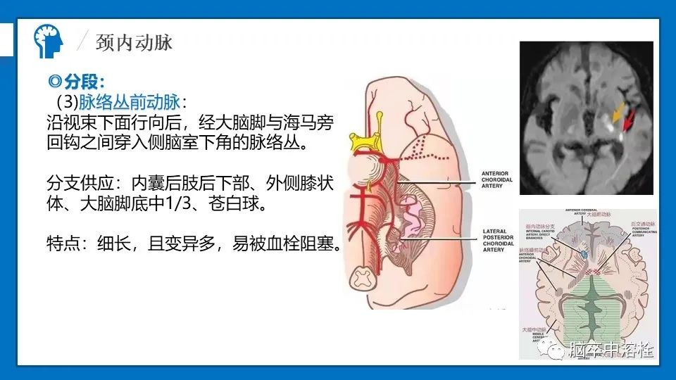 影像PPT - 【PPT】脑血管经典解剖-10