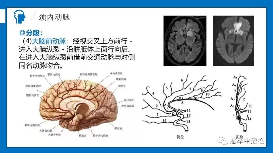 影像PPT - 【PPT】脑血管经典解剖-12