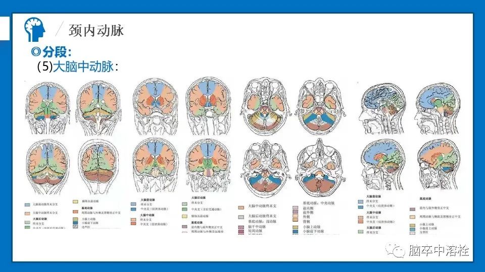 影像PPT - 【PPT】脑血管经典解剖-16