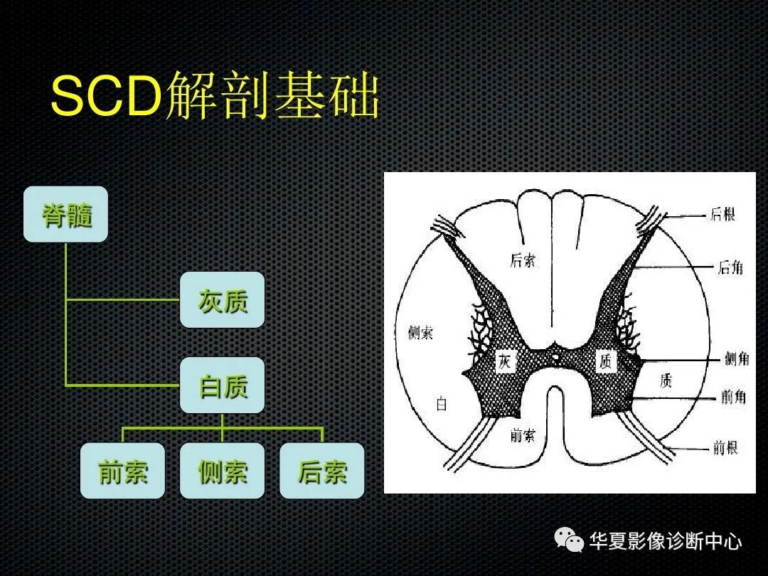 影像PPT - 【PPT】脊髓亚急性联合变性的MRI诊断-3