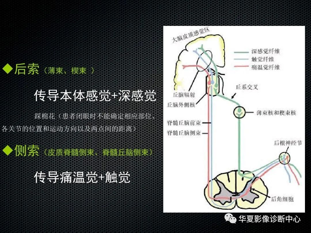 影像PPT - 【PPT】脊髓亚急性联合变性的MRI诊断-6