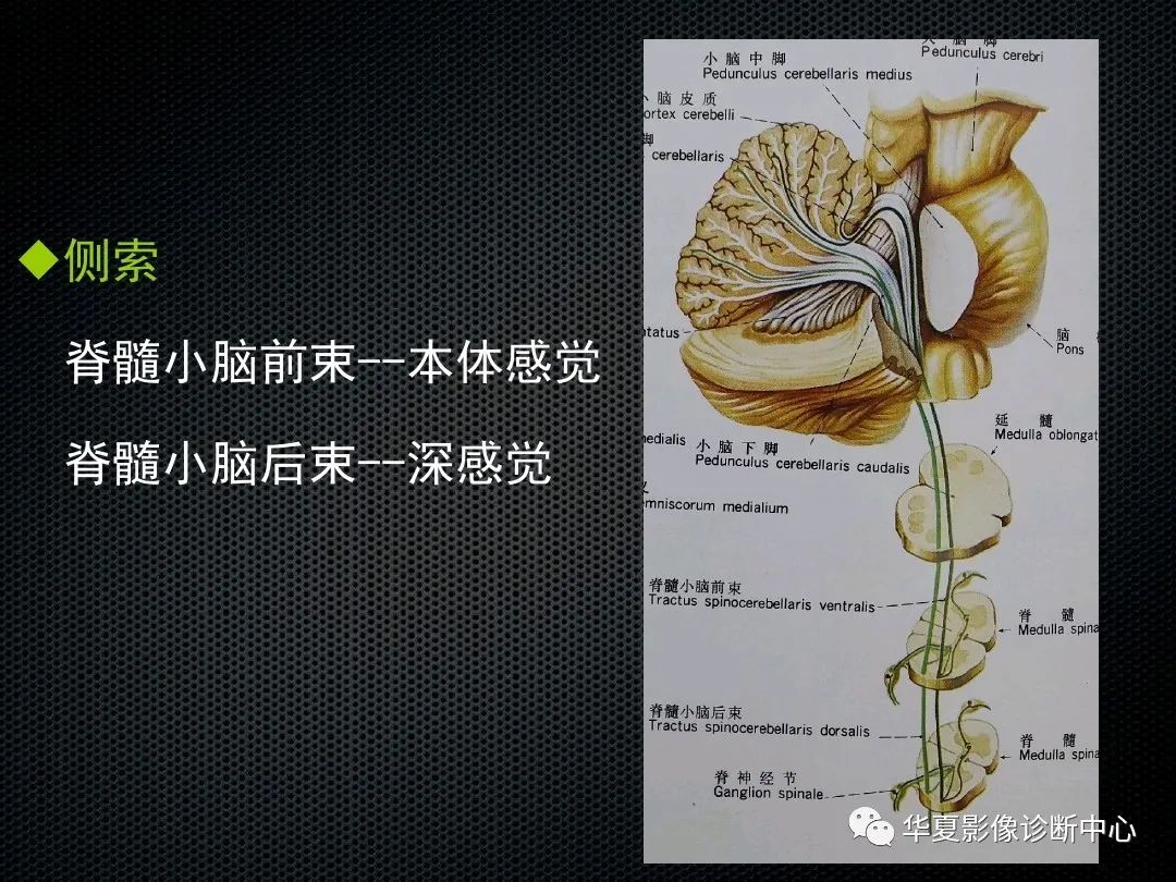 影像PPT - 【PPT】脊髓亚急性联合变性的MRI诊断-7