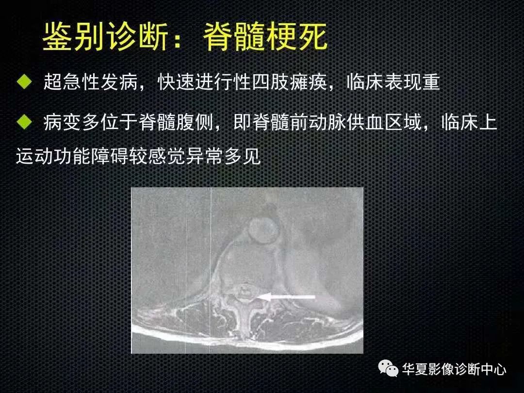 影像PPT - 【PPT】脊髓亚急性联合变性的MRI诊断-25