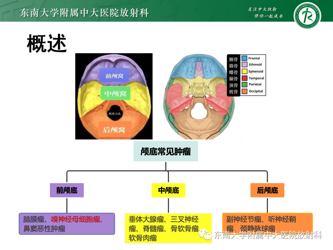 影像PPT - 【PPT】嗅神经母细胞瘤-7