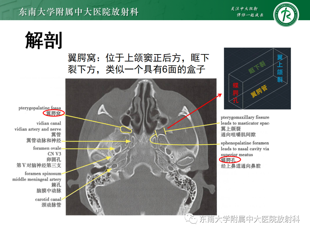 影像PPT - 【PPT】嗅神经母细胞瘤-6