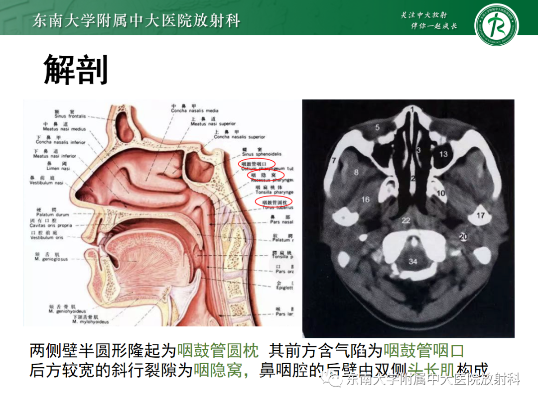 影像PPT - 【PPT】嗅神经母细胞瘤-5