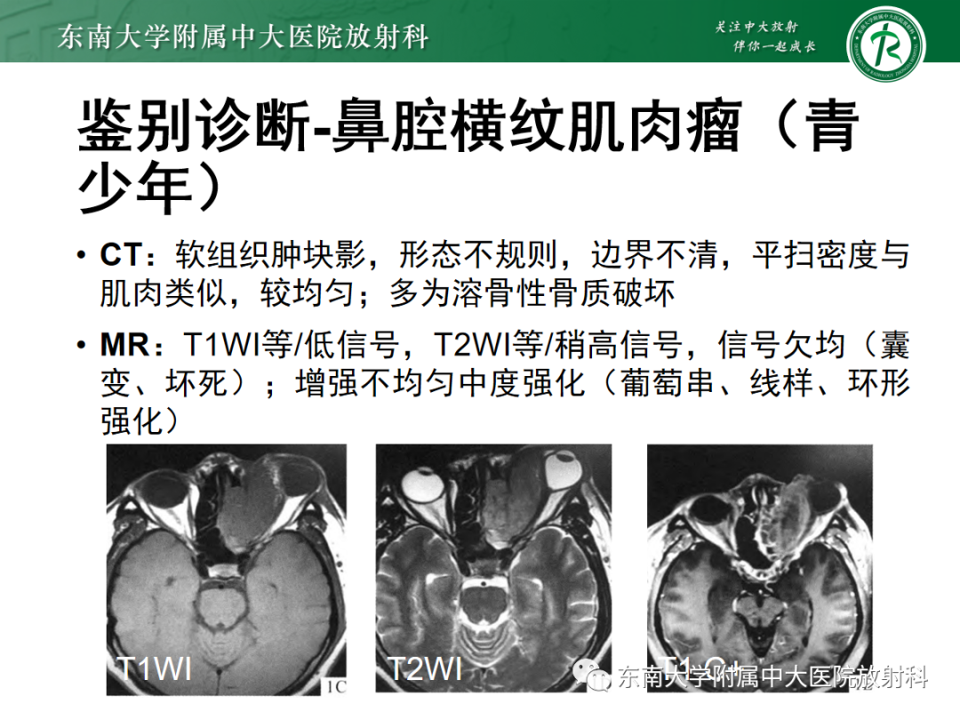 影像PPT - 【PPT】嗅神经母细胞瘤-17