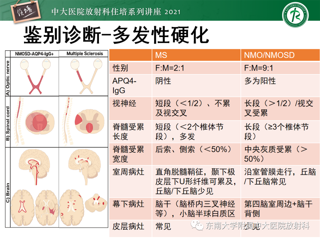 影像PPT - 【PPT】视神经脊髓炎谱系疾病影像表现及鉴别诊断-34