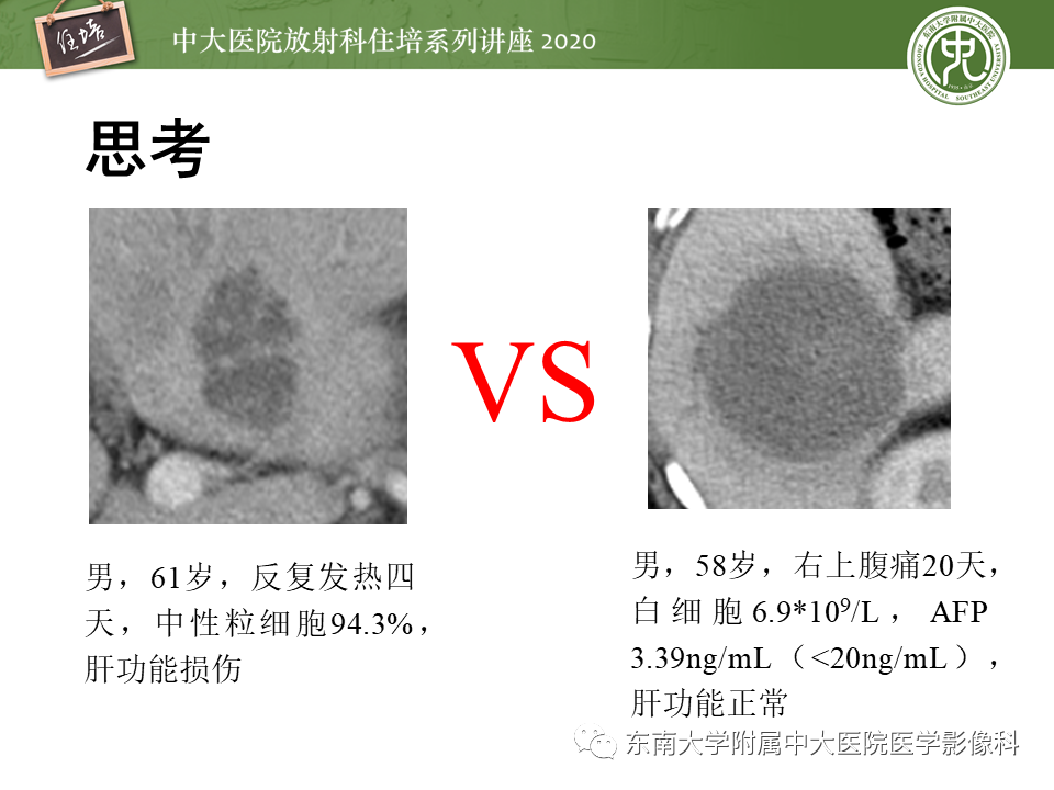影像PPT - 【PPT】肝脏感染性病变的诊断及鉴别-4