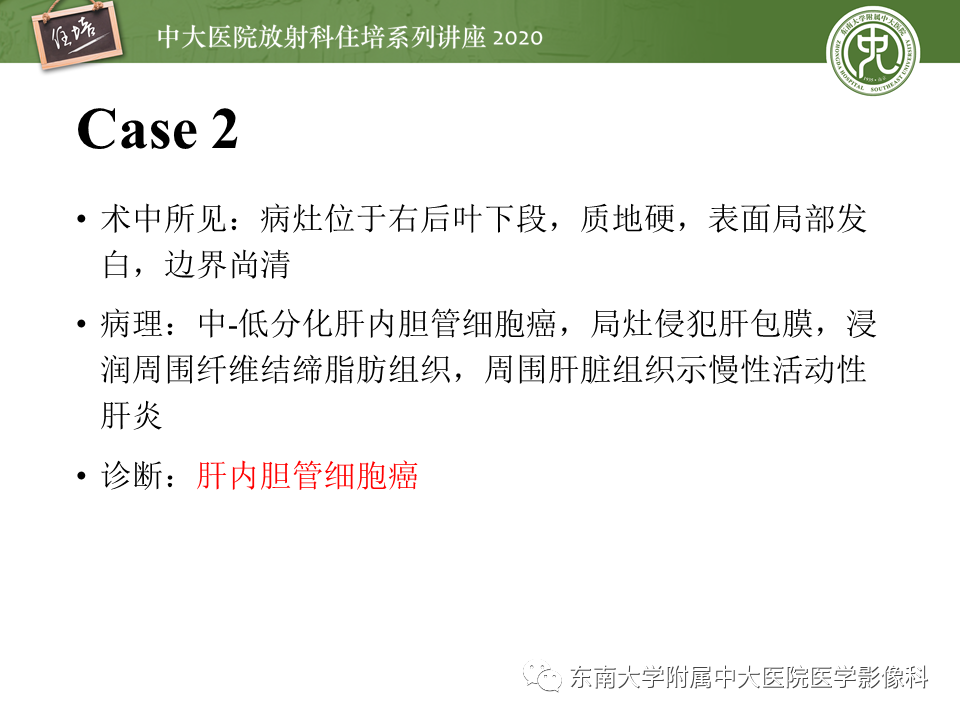 影像PPT - 【PPT】肝脏感染性病变的诊断及鉴别-7