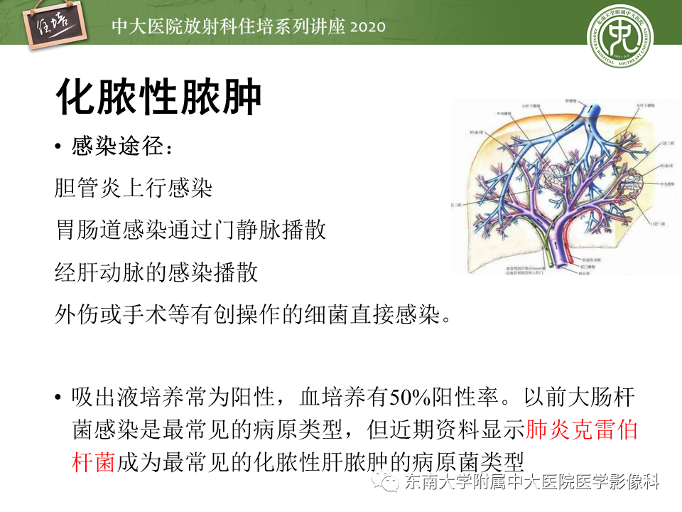 影像PPT - 【PPT】肝脏感染性病变的诊断及鉴别-10