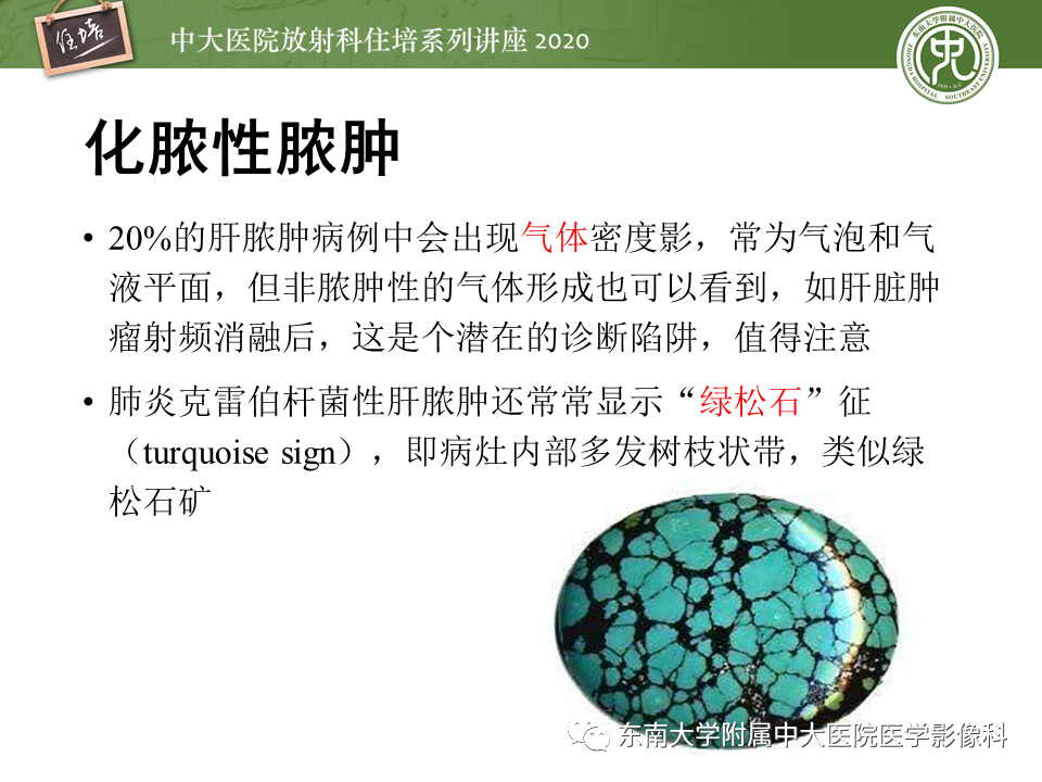 影像PPT - 【PPT】肝脏感染性病变的诊断及鉴别-18