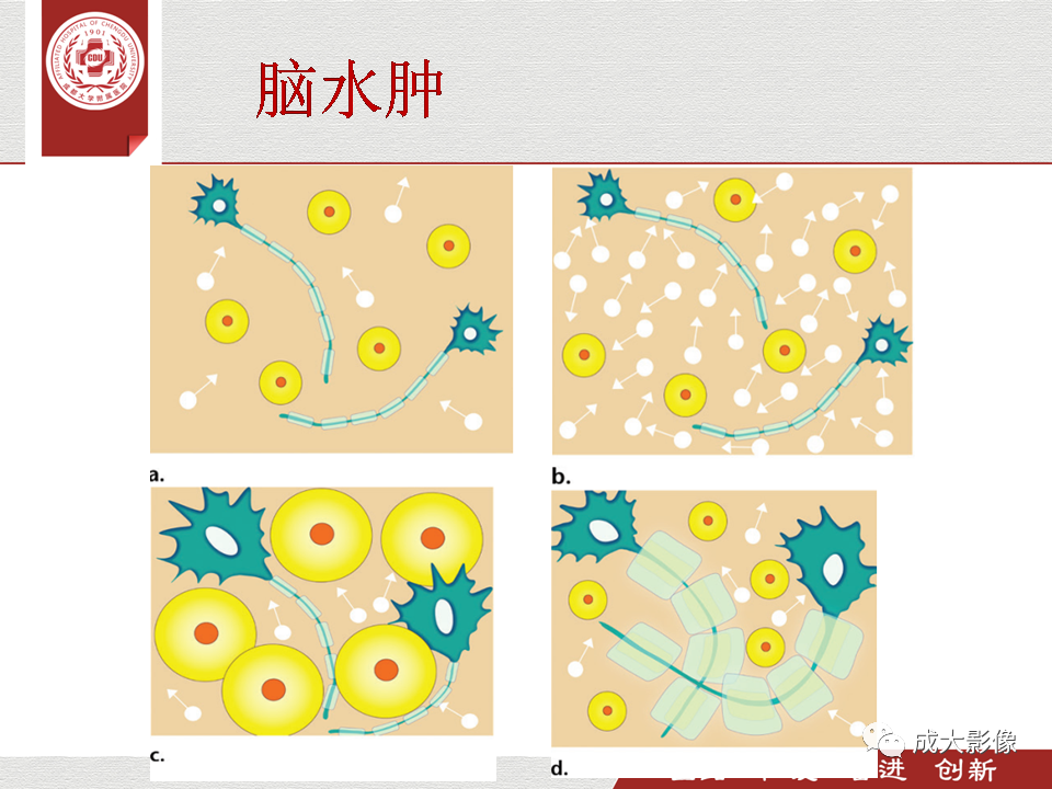 影像PPT - 【PPT】毒性和代谢性脑疾病的影像-12