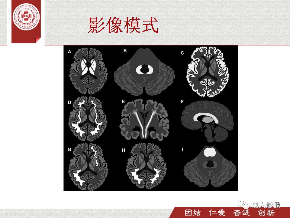 影像PPT - 【PPT】毒性和代谢性脑疾病的影像-13