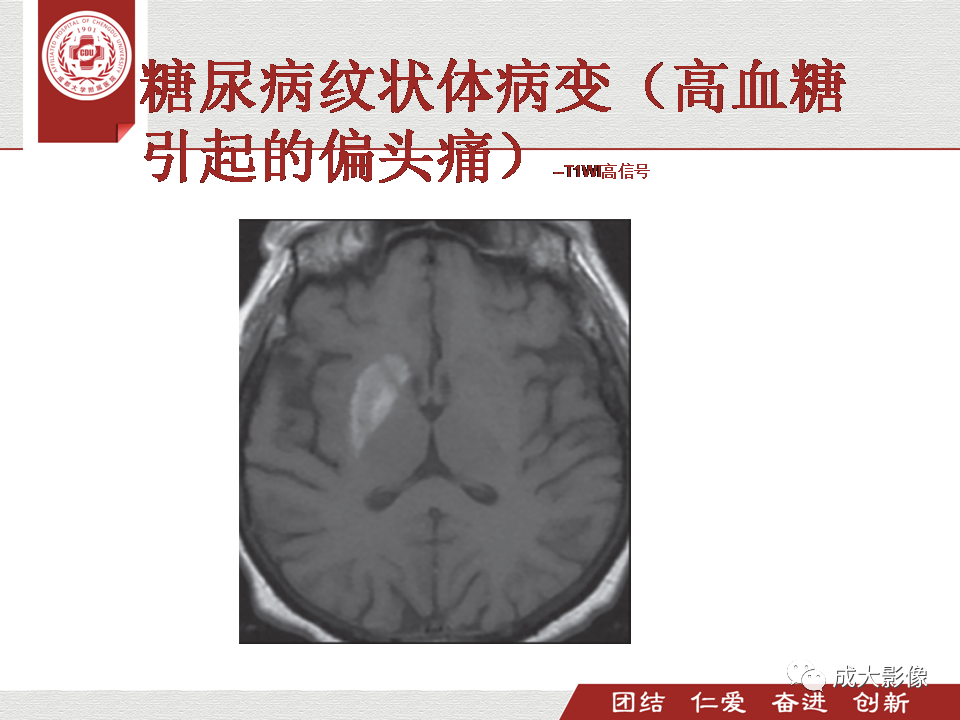 影像PPT - 【PPT】毒性和代谢性脑疾病的影像-24
