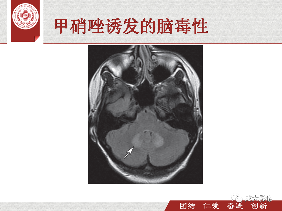 影像PPT - 【PPT】毒性和代谢性脑疾病的影像-27