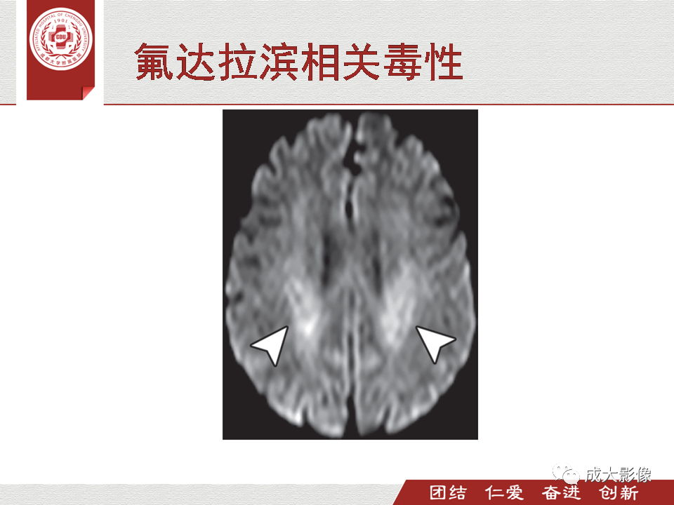 影像PPT - 【PPT】毒性和代谢性脑疾病的影像-35