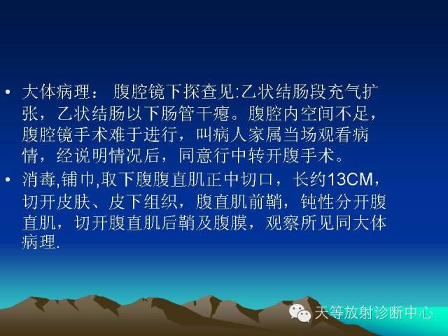 影像PPT - 【病例】成人型先天性巨结肠1例X线及CT-9
