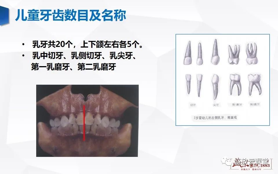 影像PPT - 【PPT】儿童牙齿的解剖和变异-3