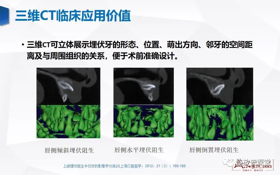 影像PPT - 【PPT】儿童牙齿的解剖和变异-16