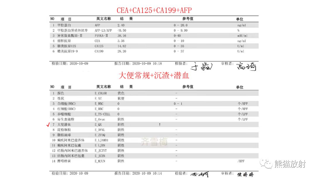 影像PPT - 【PPT】胰腺实性假乳头状瘤1例MR-3