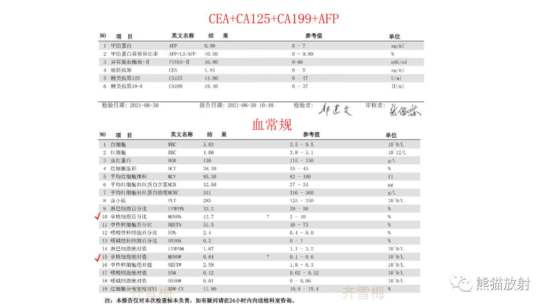 影像PPT - 【PPT】胰腺实性假乳头状瘤1例MR-20