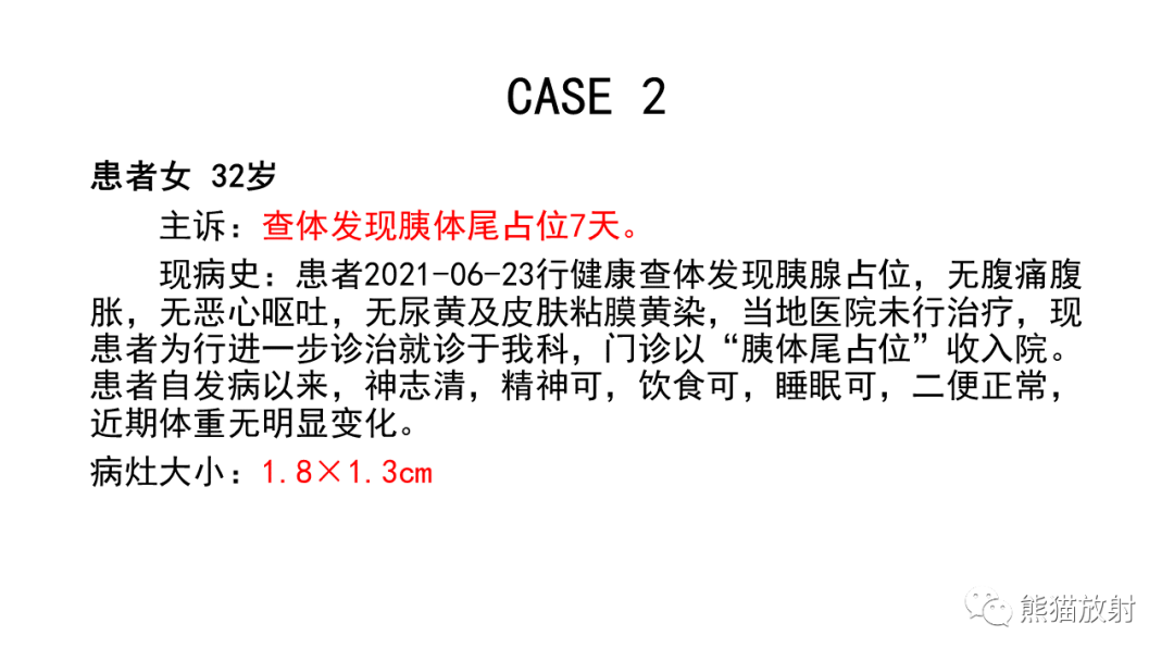 影像PPT - 【PPT】胰腺实性假乳头状瘤1例MR-19
