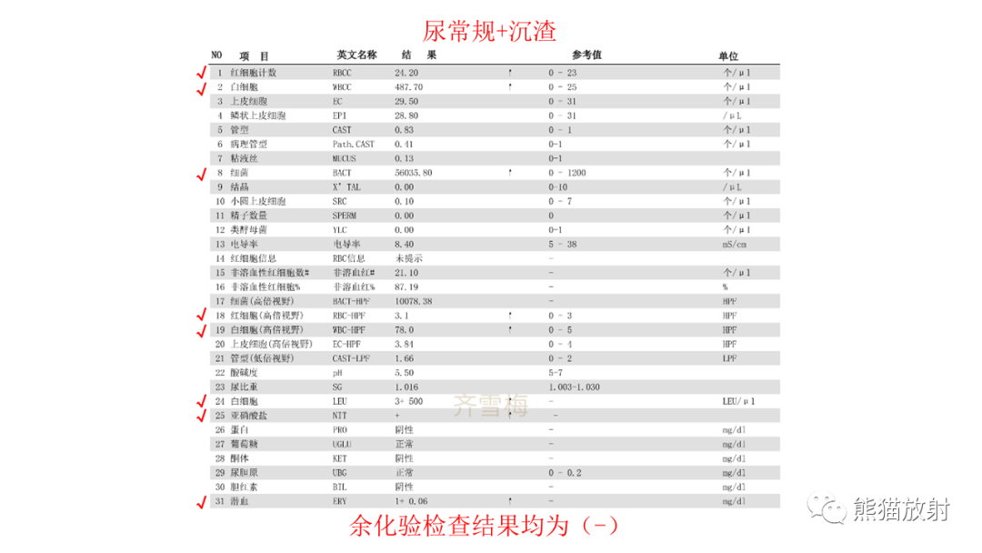 影像PPT - 【PPT】胰腺实性假乳头状瘤1例MR-21