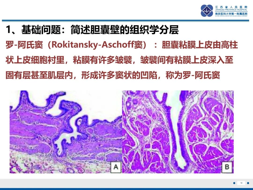 影像PPT - 【PPT】胆囊腺肌症-13