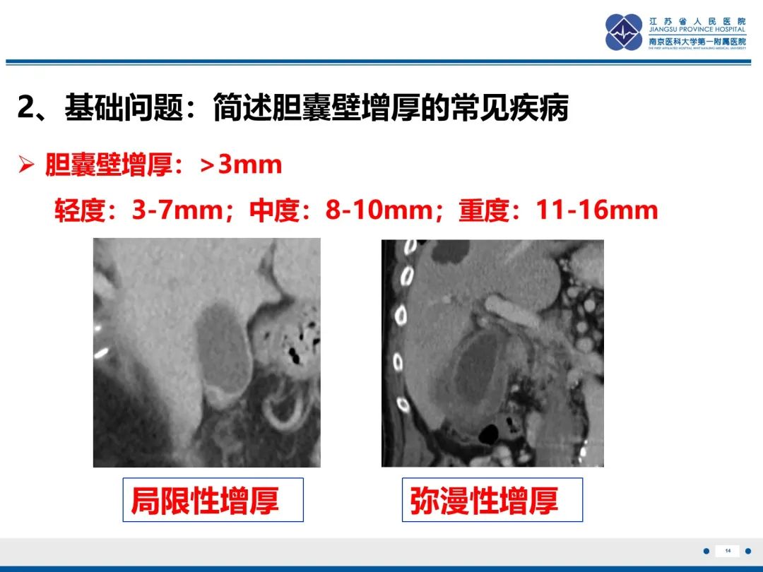 影像PPT - 【PPT】胆囊腺肌症-15