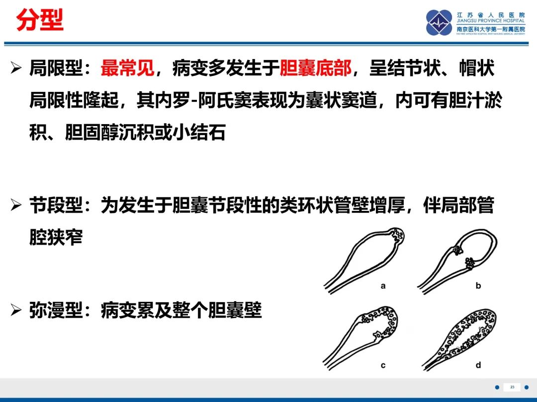 影像PPT - 【PPT】胆囊腺肌症-24