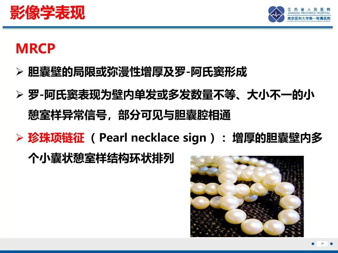 影像PPT - 【PPT】胆囊腺肌症-28