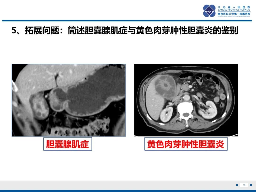 影像PPT - 【PPT】胆囊腺肌症-33