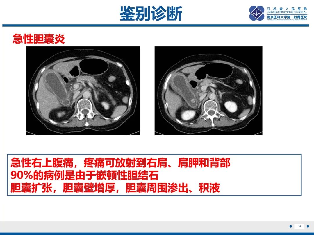 影像PPT - 【PPT】胆囊腺肌症-36