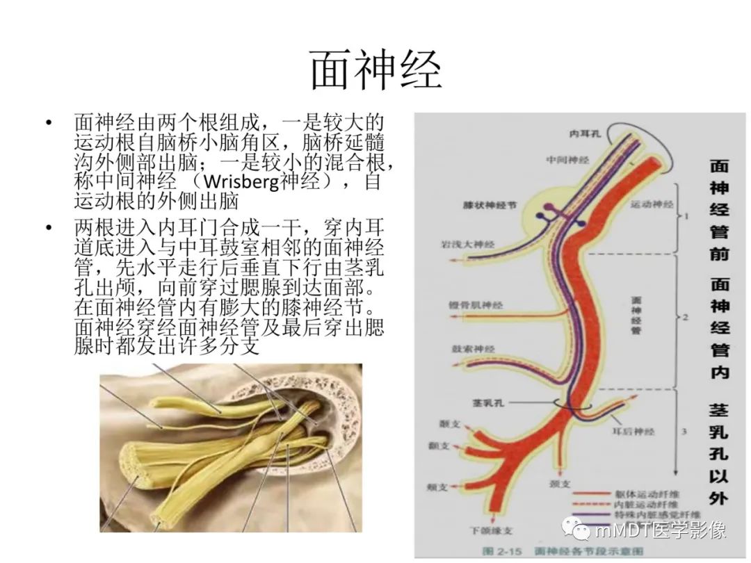 影像PPT - 【PPT】行走在孔道里的面神经-4