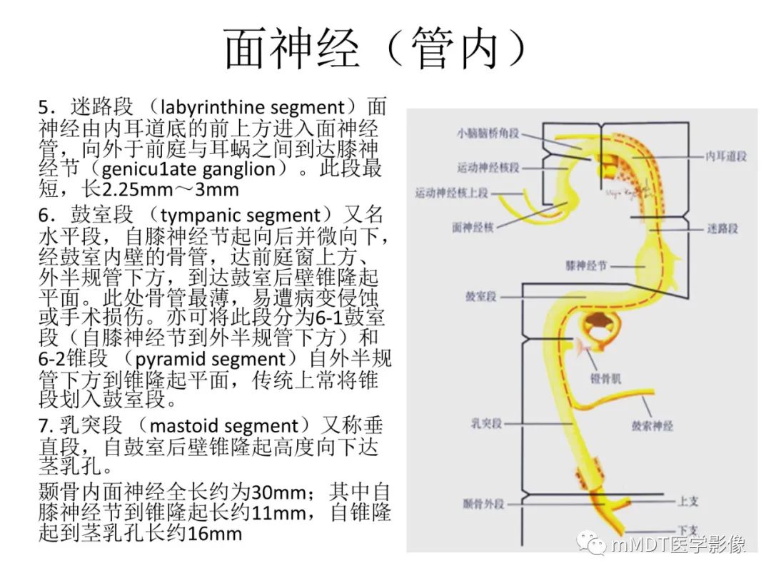 影像PPT - 【PPT】行走在孔道里的面神经-7