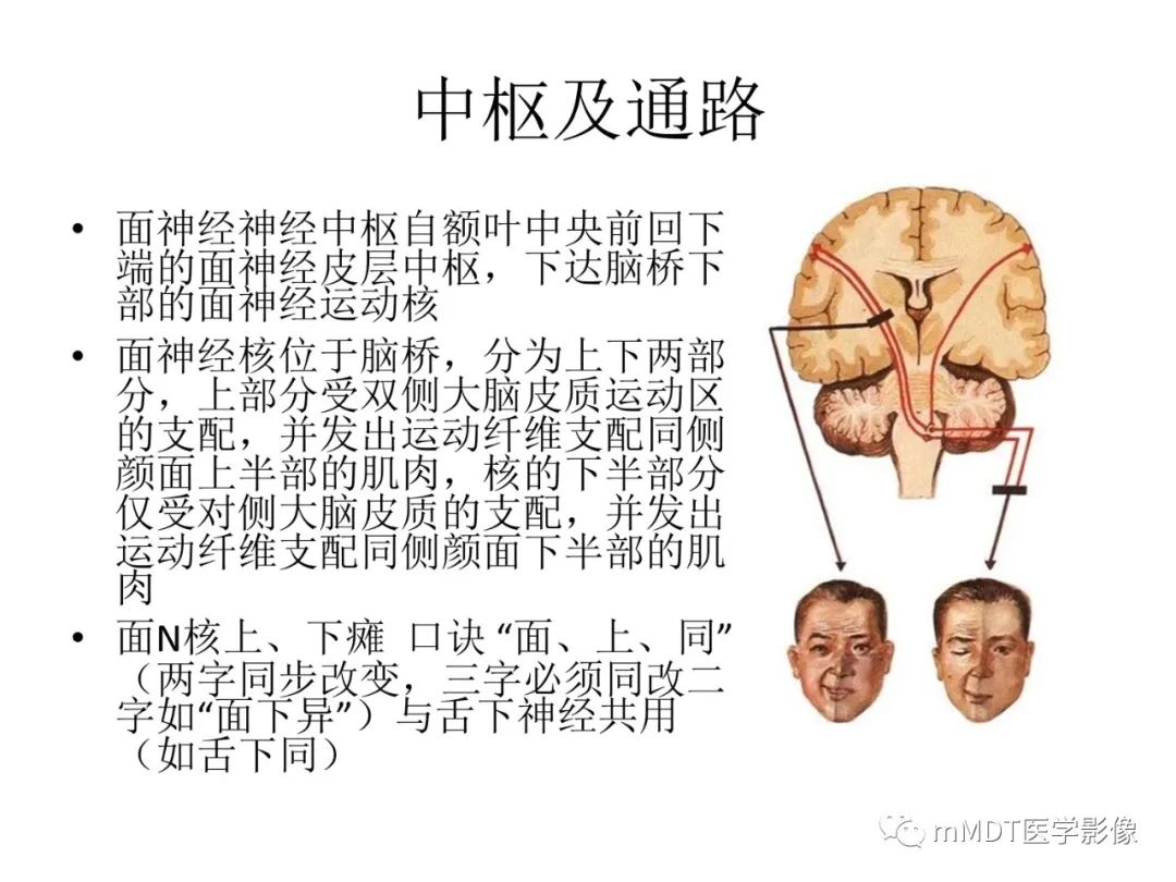 影像PPT - 【PPT】行走在孔道里的面神经-6